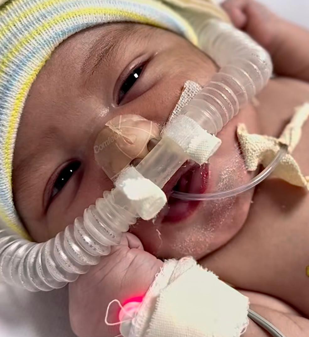 Filha de goiana, bebê com cardiopatia congênita consegue cirurgia em SP