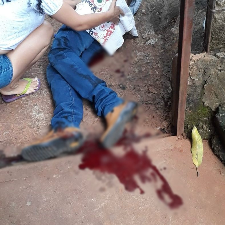 Homem leva tiros depois de jogo de sinuca em boteco de Goianésia