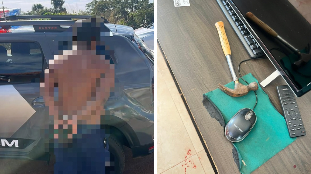 Menino de 12 anos é agredido pelo padrasto com martelada ao tentar defender a mãe