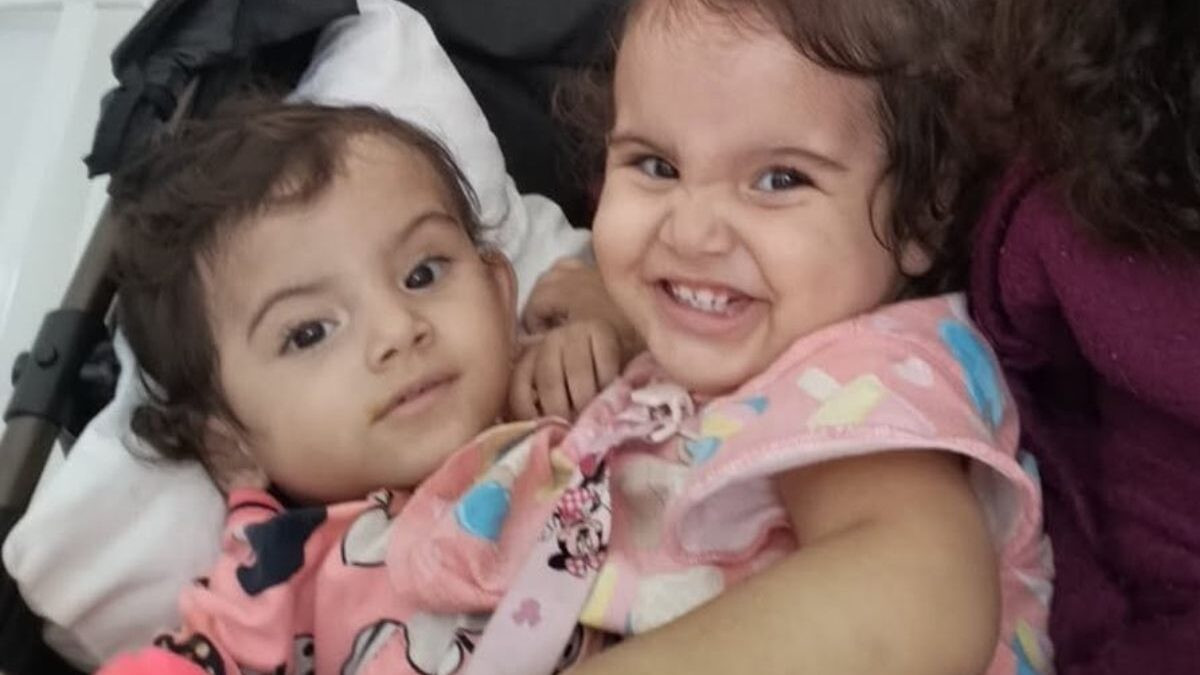 Cirurgia de separação de gêmeas siamesas é concluída em Goiânia