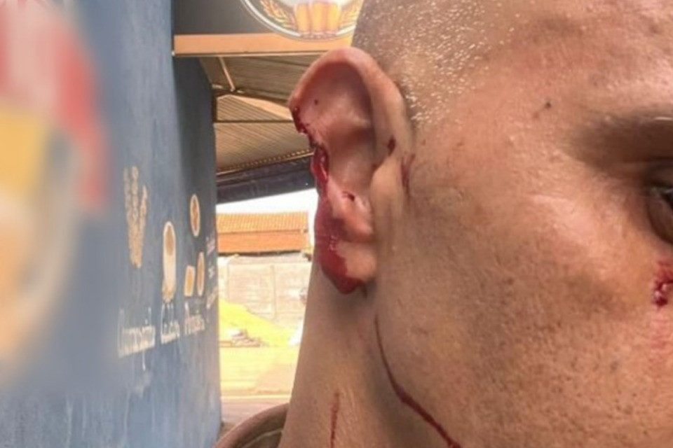 Policial perde pedaço da orelha por conta de mordida em ocorrência em São Miguel do Araguaia
