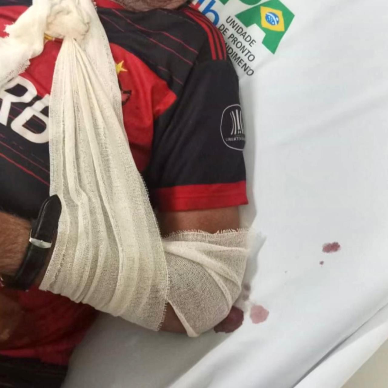 Há 2 anos sem fazer cirurgia ortopédica Goianésia envia pacientes para outras cidades